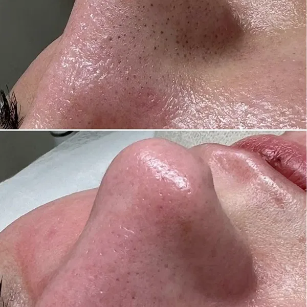 Aqua Beauty Masaj Resim 4